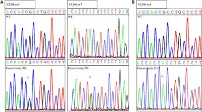 A Novel CLN6 Variant Associated With Juvenile Neuronal Ceroid Lipofuscinosis in Patients With Absence of Visual Loss as a Presenting Feature